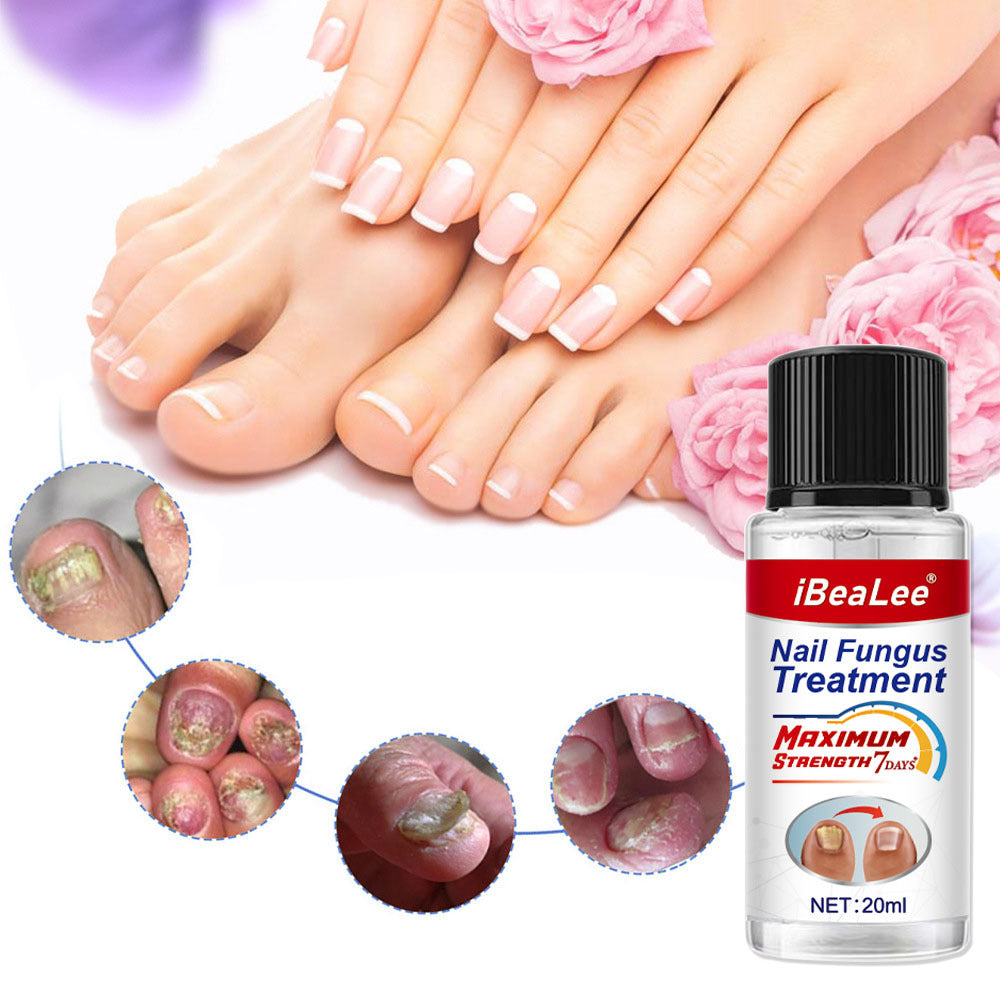 Thickening Of Special Bacteriostatic Liquid For Onychomycosis - 0 - CJ