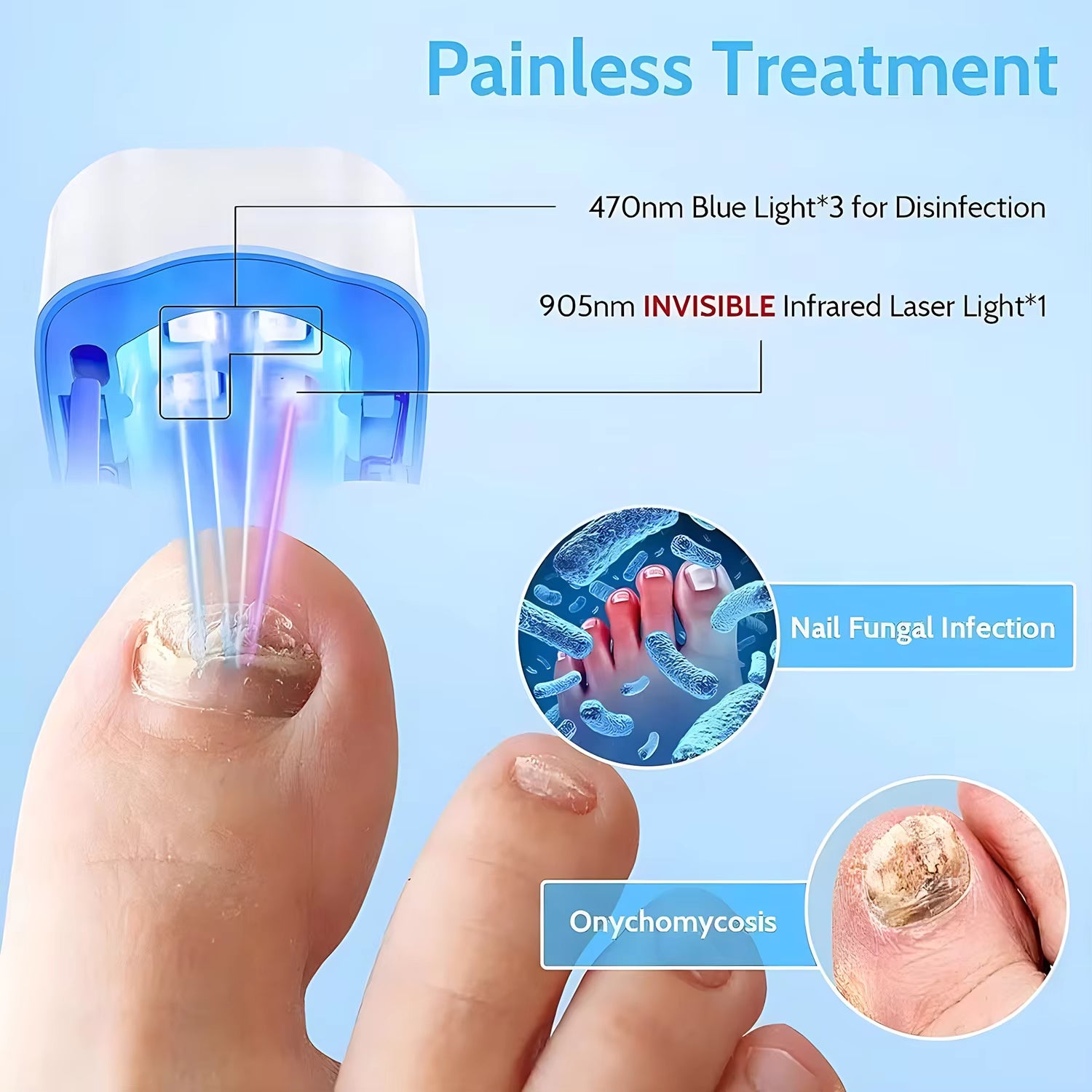 Nail Fungus Laser Treatment LED Light Device Effective Rechargeable Nail Fungus Remover Nail Fungus Cleaning Laser Device Repair Damaged Discolored Thick Fingernails - 5 - CJ
