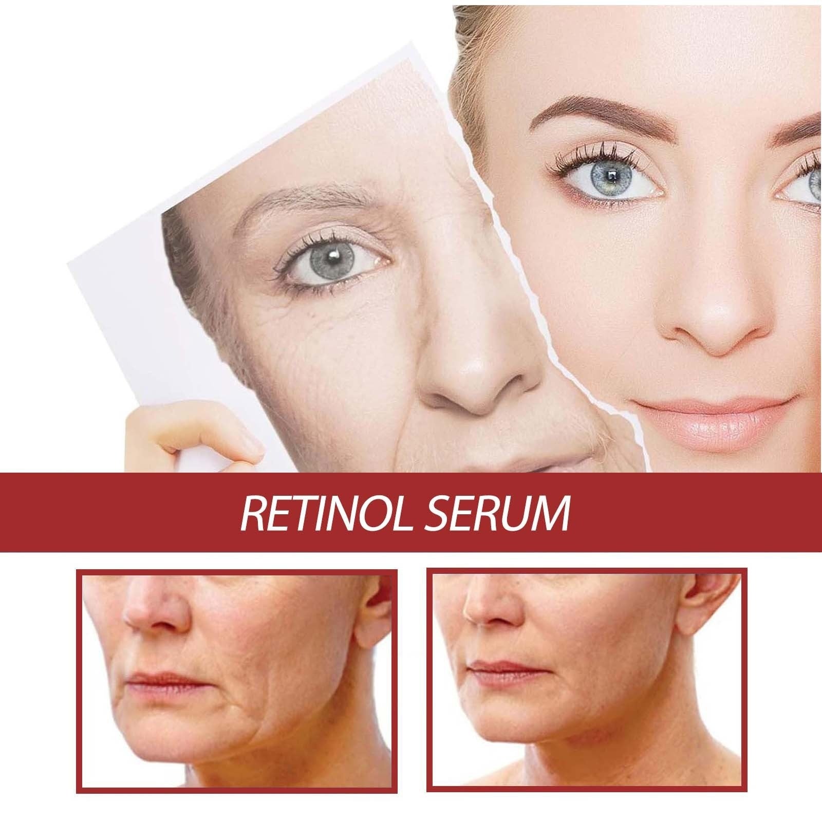 Moisturizing Firming And Tender Retinol Essence - 0 - CJ