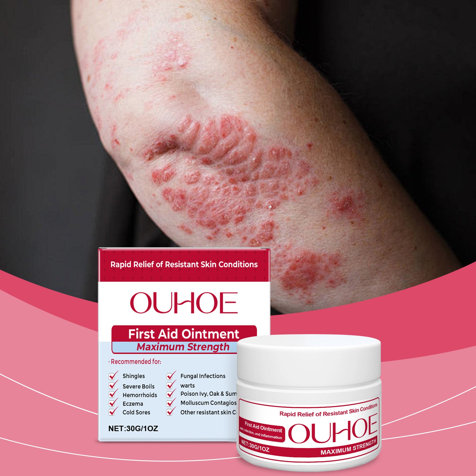 OUHOE Skin Soothing Cream, To Relieve Skin Redness And Discomfort Gentle Care Moisturizes Skin Topical Soothing Cream - 5 - CJ