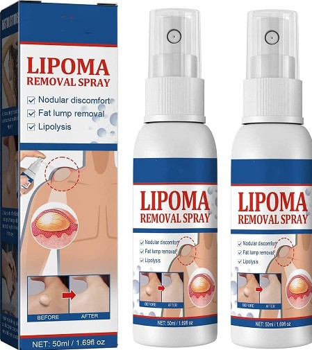 South Moon - Lipoma Removal Spray - 5 - CJ