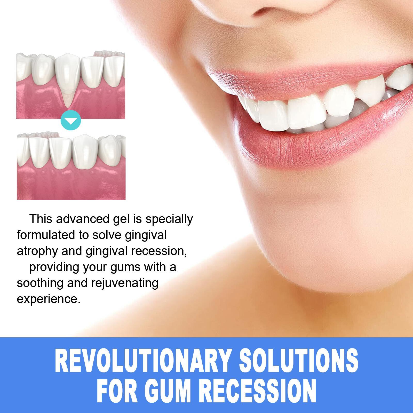 Yierhao Tooth Repair Gel, Repair Gums, Clean Teeth Stains, Tartar, Oral Care - 5 - CJ