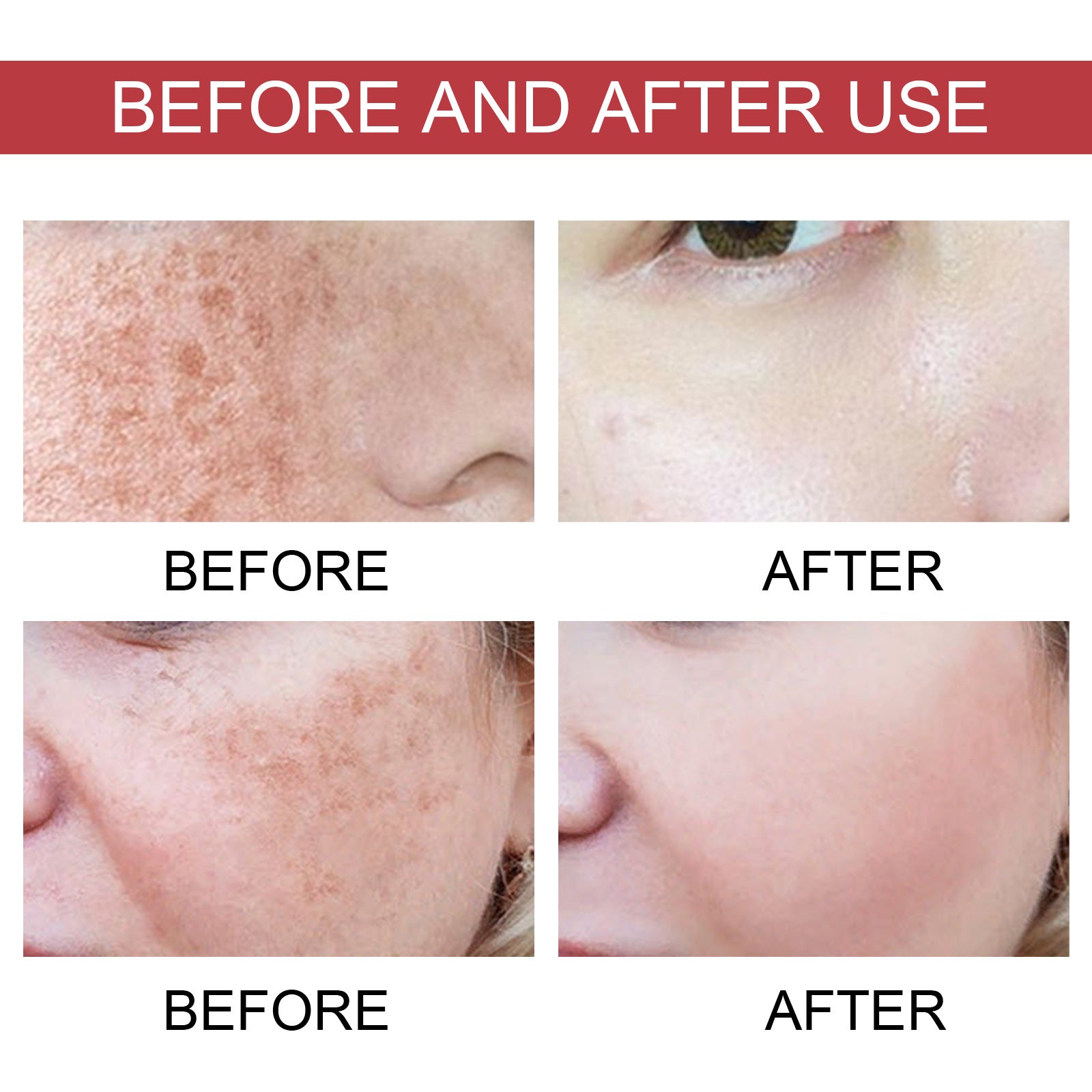 Hoygi Black Spot Repair Essence Lighten Skin Black Spot And Age Spot Moisturizing&Brightening Repair Essence - 5 - CJ