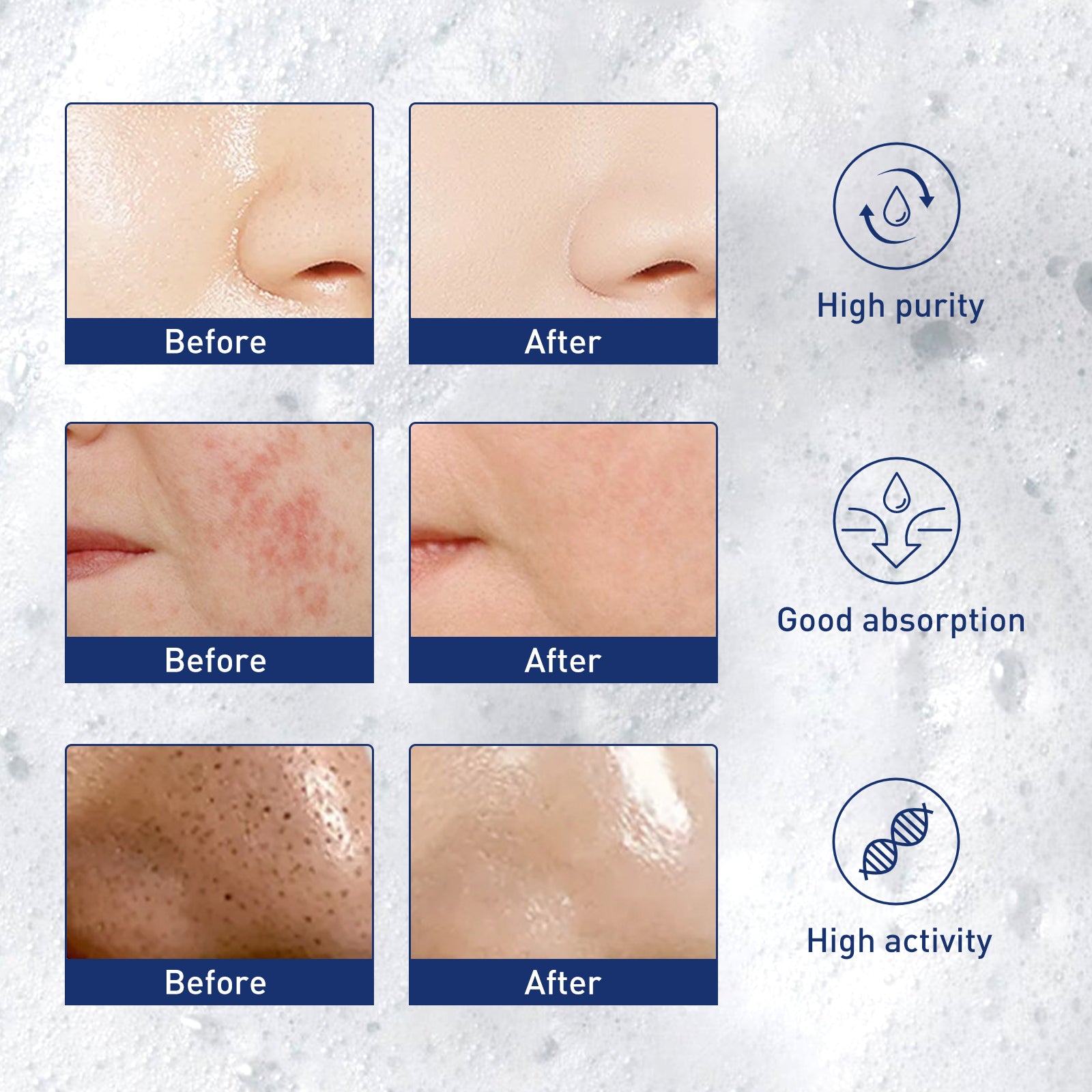 West&Month Exfoliating Mousse, Cleanser Skin Pore Control Oil Gently Cleanses Exfoliating Dead Blackheads - 5 - CJ
