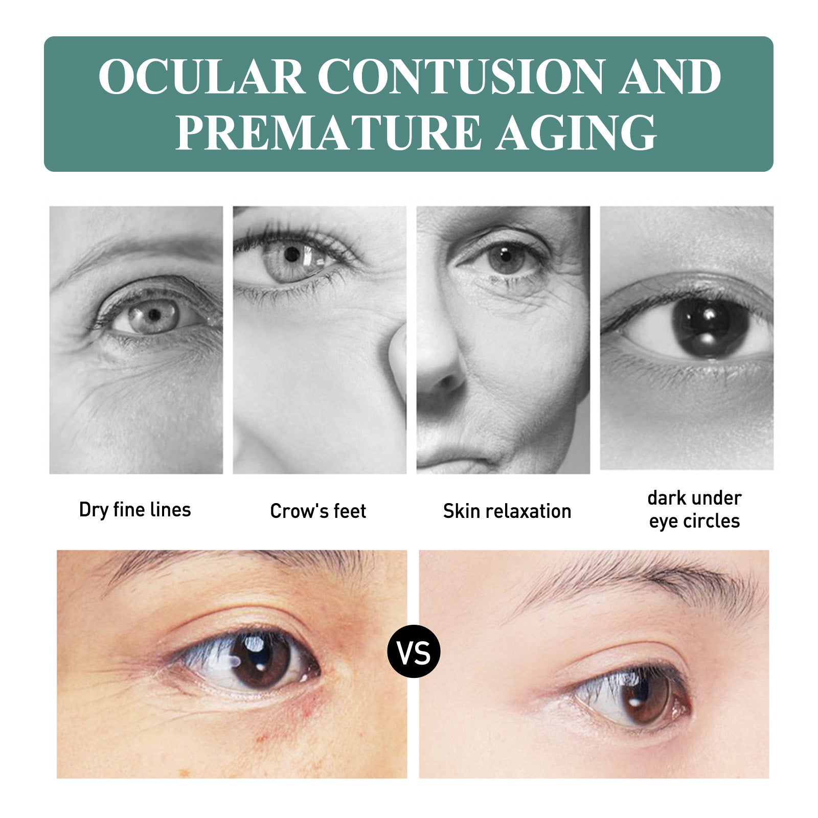 EELHOE Anti - Wrinkle Eye Cream Protects The Skin Around The Eyes And Reduces Dark Spots, Dry Lines And Fine Lines - 5 - CJ
