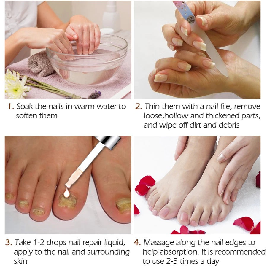 Thickening Of Special Bacteriostatic Liquid For Onychomycosis - 0 - CJ
