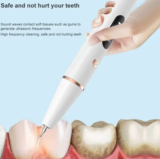 Smart Ultra - Sonic Teeth Cleaner - 5 - CJ