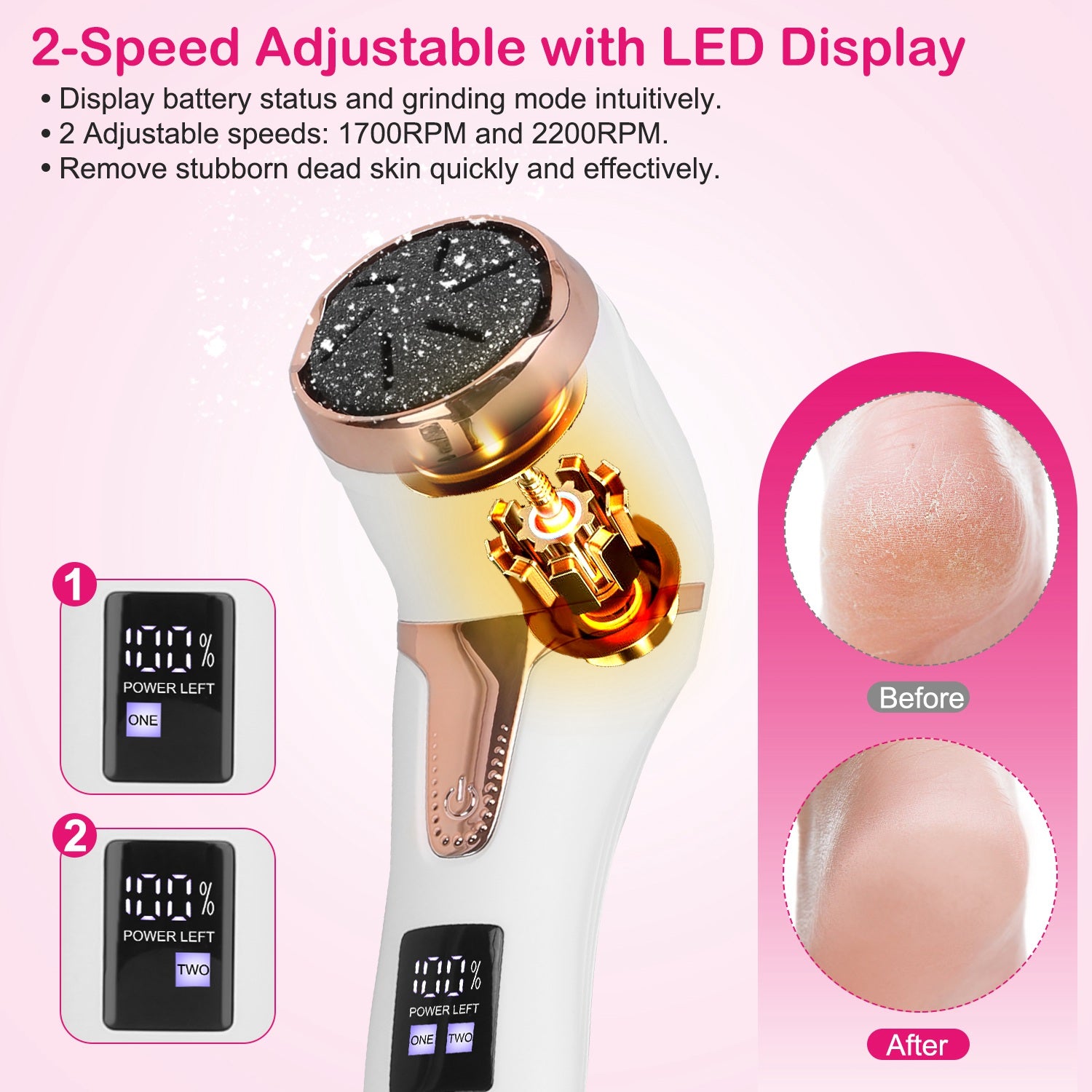 17Pcs Electric Foot Callus Remover With Vacuum Foot Grinder Rechargeable Foot File Dead Skin Pedicure Machine With 3 Grinding Heads 2 Speeds Foot Care Tool - 5 - CJ