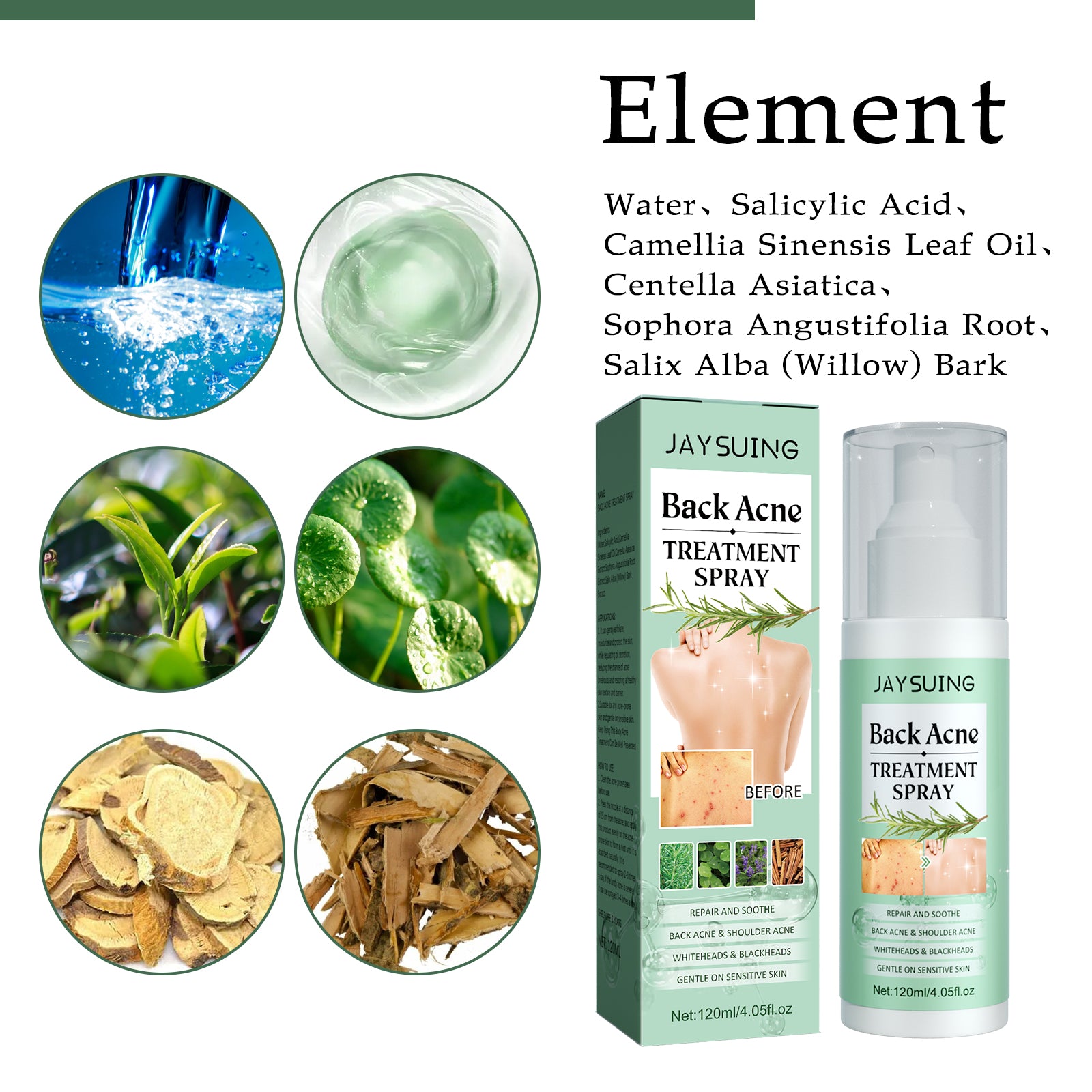 Jaysuing Back Acne Repair Spray, Repair Body Acne Fade Acne Mark Skin Care Spray - 5 - CJ