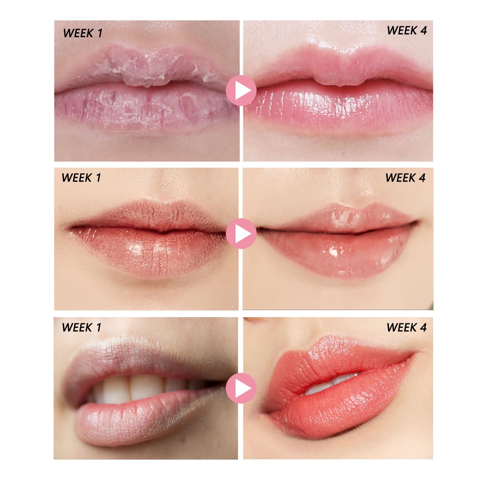 EELHOE Peach Lip Scrub For Fading Lip Lines, Removing Dead Skin, And Hydrating Moisturizing Lip Exfoliation - 5 - CJ