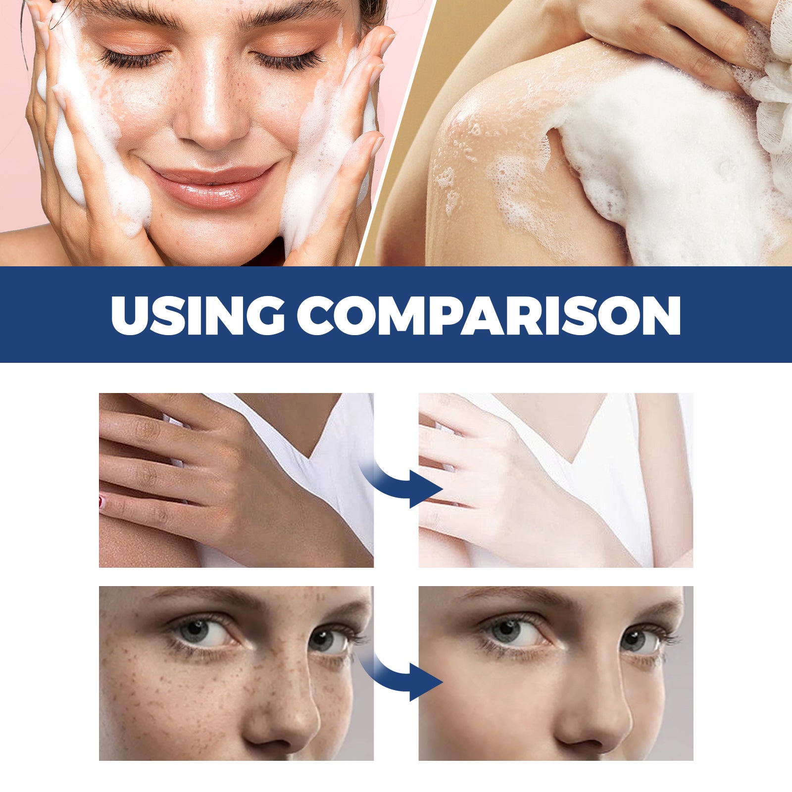 Jaysuing Spot Body Cleanser, Face Body Cleansing Skin Fade Spot Whitening Beauty Skin Cream - 5 - CJ
