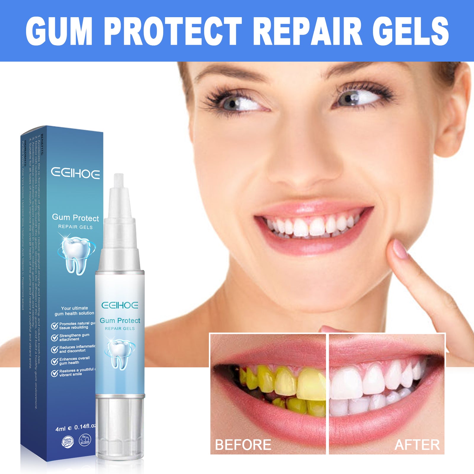 EELHOE Dental Repair Gel, Repair Gums Cleaning Dental Stains And Tartar Oral Care Gel - 5 - CJ