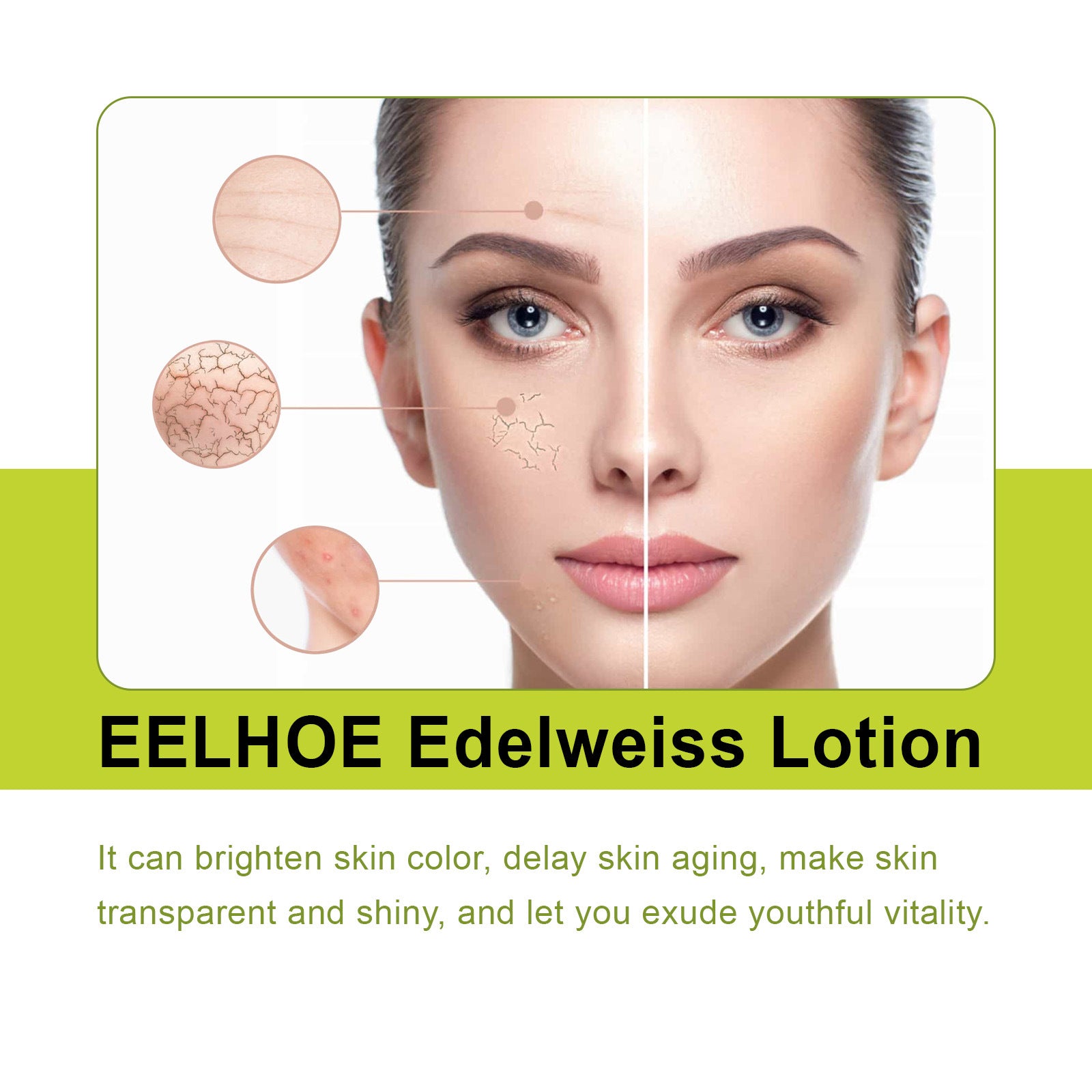 EELHOE Edelweiss Lotion, Moisturizing And Brightening Face Dull And Shiny Skin Moisturizing Lotion - 5 - CJ