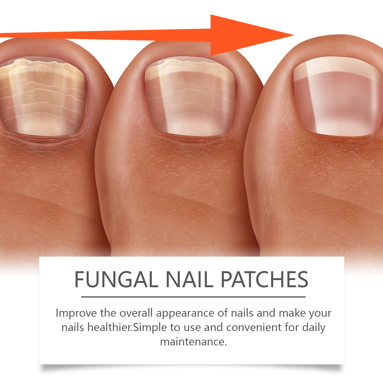 Ximonth Nail Care Patches Gently Repair Nails For Easy Daily Cleaning With Simple Care Patches - 5 - CJ