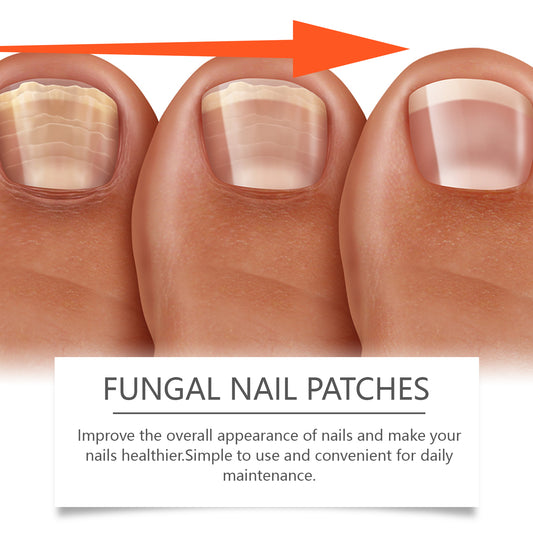 Ximonth Nail Care Patches Gently Repair Nails For Easy Daily Cleaning With Simple Care Patches - 5 - CJ
