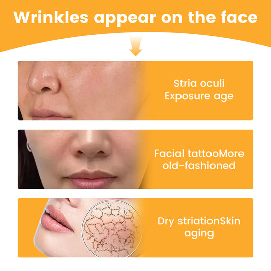 EELHOE Nasolabial Folds Patch, Fade Fine Lines Law Lines Lifting And Tightening Facial Skin Moisturizing And Hydrating - 5 - CJ