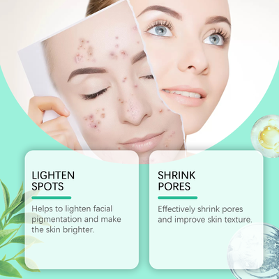 Hoygi Salicylic Acid Care Patch Oil Control Refreshing Gentle Clean Care Skin Hydrating Moisturizing Cleanser - 5 - CJ