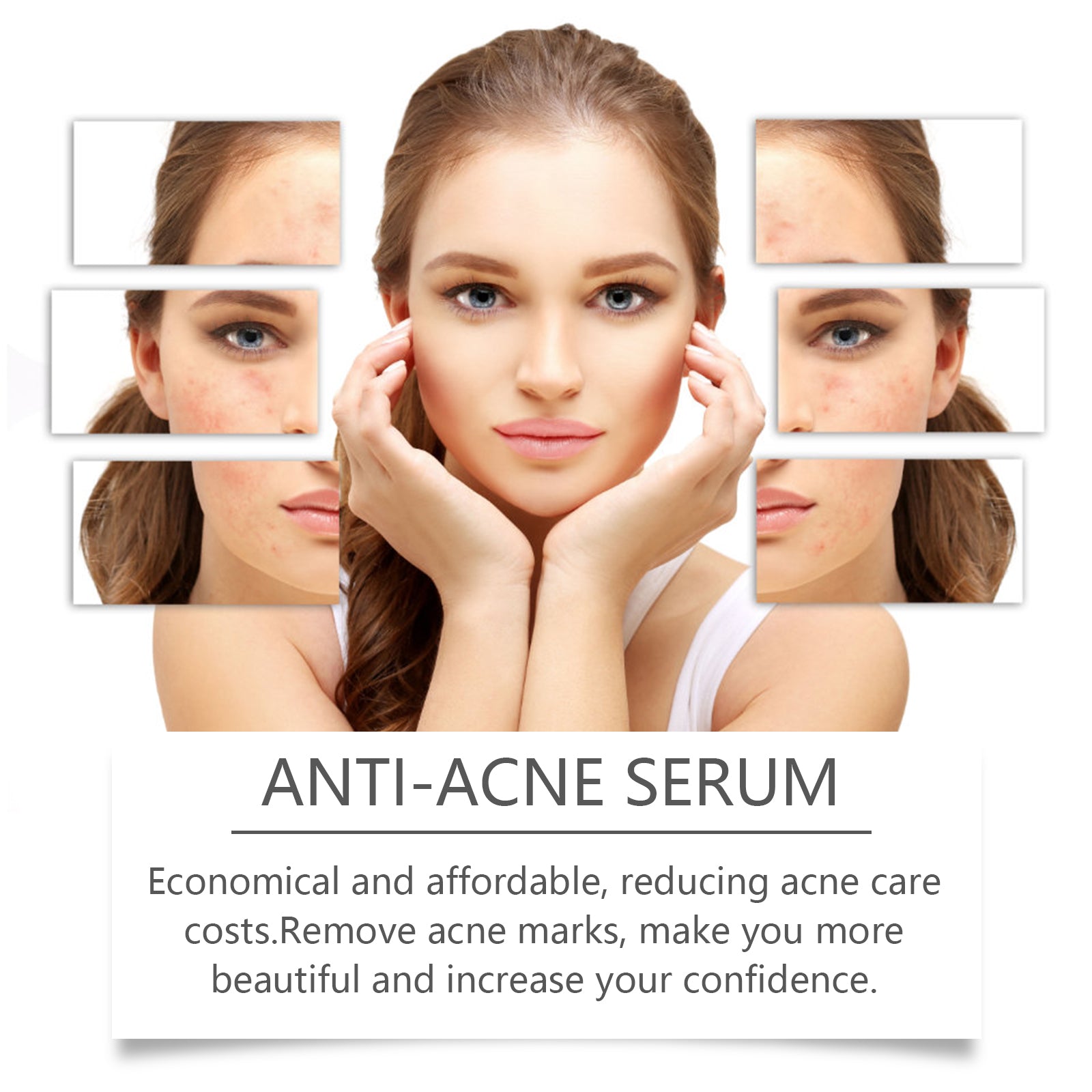 Hoygi Nicotinamide Anti - Acne Serum Mild Anti - Acne Serum Improve Acne Moisturizing Repair Serum - 5 - CJ