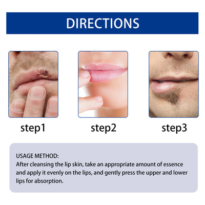 EAST MOON Lip Essence Rolling Lotion, Moisturize And Fade Lip Lines, Prevent Dry Crack And Dead Skin, Plump And Moisturize Lips - 5 - CJ