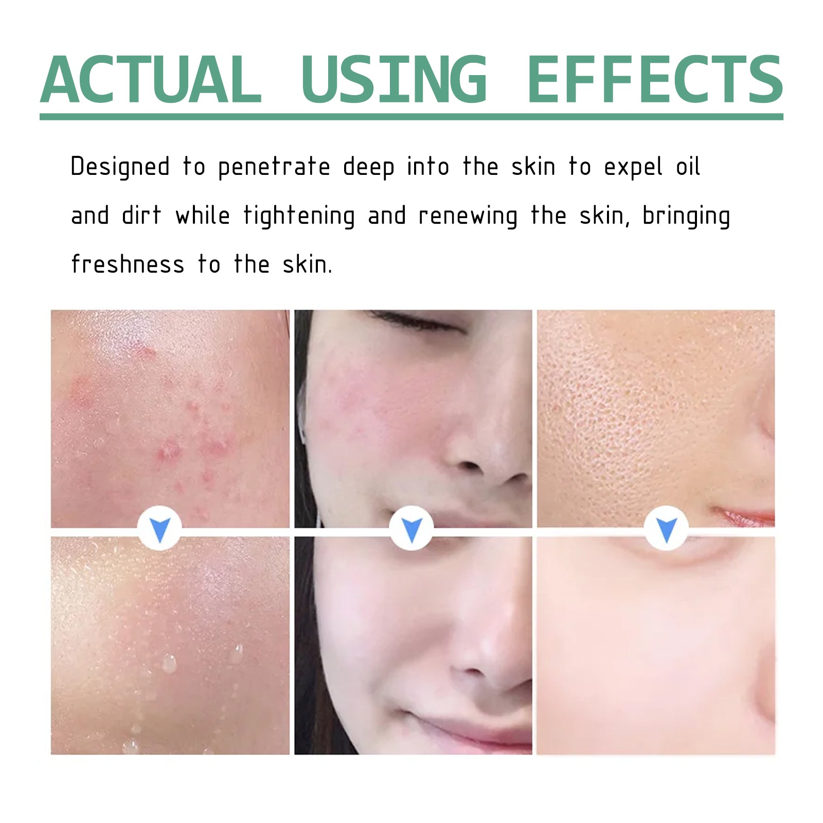 Hoygi Green Tea Cleansing Mud Mask, Facial Cleansing Moisturizing Whitening Skin Blackhead Acne Removing Mud Mask - 5 - CJ