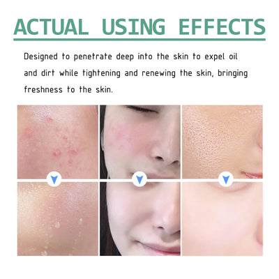 Hoygi Green Tea Cleansing Mud Mask, Facial Cleansing Moisturizing Whitening Skin Blackhead Acne Removing Mud Mask - 5 - CJ