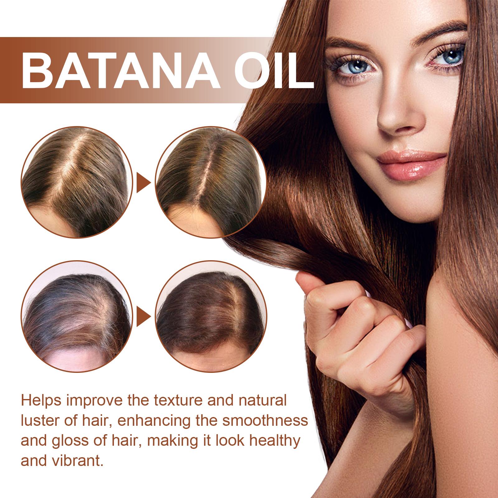 Batana Oil From Honduras - Get Fuller, Thicker, Healthier Hair - Great Gifts For Women  Men Conditioner Haircare Silky - Hair Nutrition - 5 - CJ