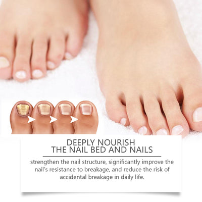West&Month Nail Repair Solution, Hand And Foot Nail Cleaning Care Gentle Moisturizing And Moisturizing Nail Repair Solution - 5 - CJ