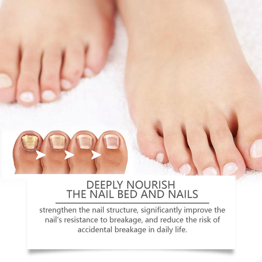 West&Month Nail Repair Solution, Hand And Foot Nail Cleaning Care Gentle Moisturizing And Moisturizing Nail Repair Solution - 5 - CJ