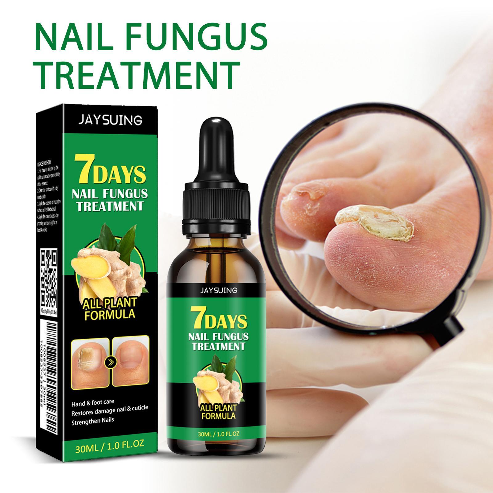 Jiasuying Ginger Nail Care Liquid, Repairs And Moisturizes Hand And Foot Nails, Makes Nails Shiny And Soft, And Improves Onychomycosis - 5 - CJ