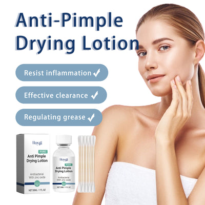 Hoygi Anti - Pimple Drying Lotion, Facial Cleansing And Repair Lighten Acne Marks And Pits, Close Your Mouth And Mild Skin Cream - 5 - CJ