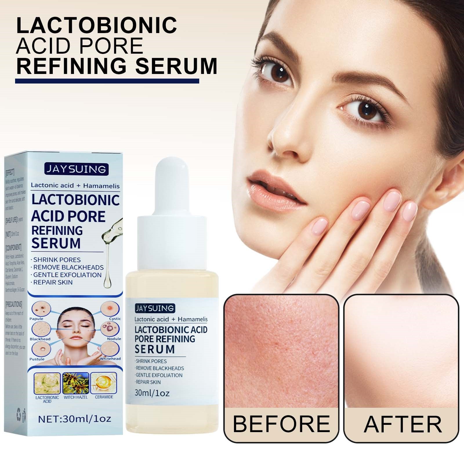 Jaysuing Lactobionic Acid Liquid Exfoliating Blackheads Shrinking Pores Cleansing Moisturizing Skin - 5 - CJ