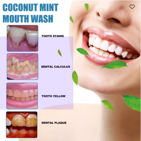 Oralhoe Coconut Mint Mouth Wash, Whitening Teeth Yellow Teeth Stains Tongue Coating Clean  Breath Oral Care - 5 - CJ
