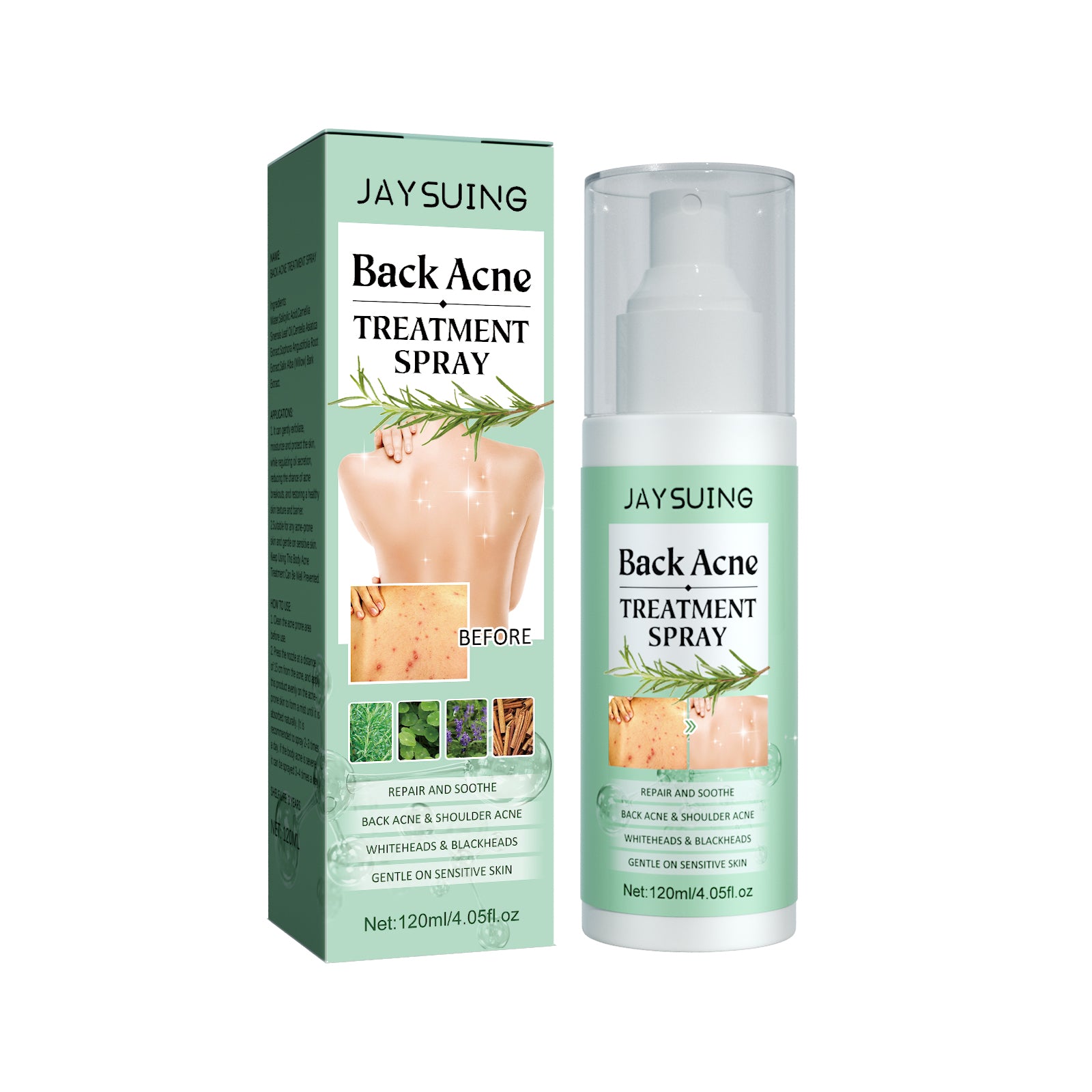 Jaysuing Back Acne Repair Spray, Repair Body Acne Fade Acne Mark Skin Care Spray - 5 - CJ