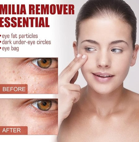 Smooth Milia Remover Serum - 5.0 - CJ