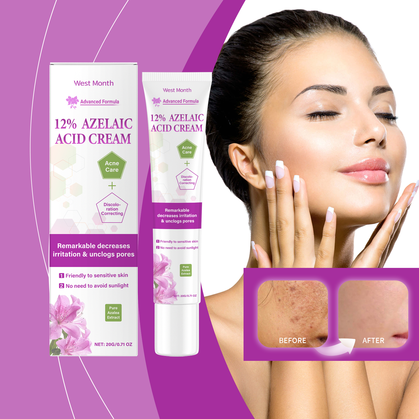 West&Month Azelaic Acid Cream Daily Acne Gentle Cleansing And Repair Skin Smooth And Moisturizing Cream - 5 - CJ