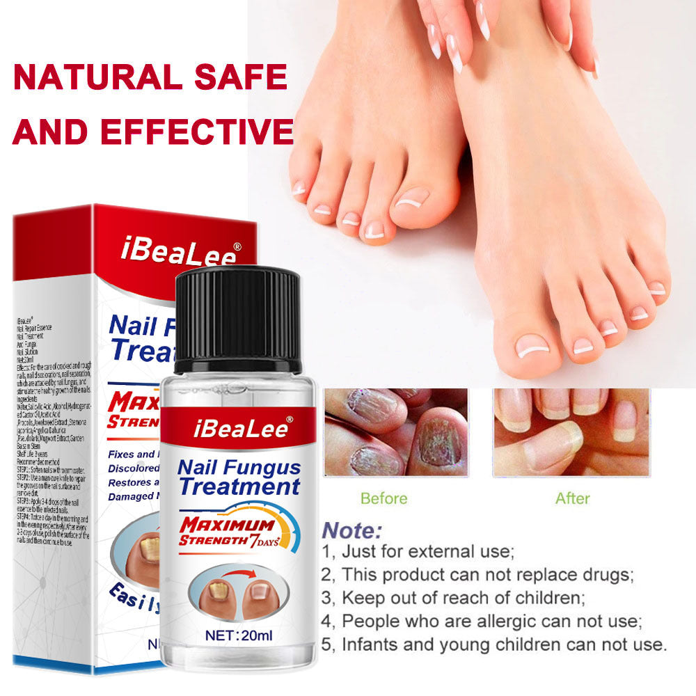 Thickening Of Special Bacteriostatic Liquid For Onychomycosis - 0 - CJ