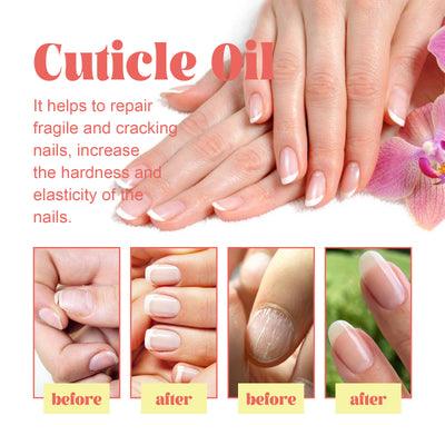 EELHOE Cuticle Oil, Repair Dry Rotted Nails Thickening Moisturizing Care Brightening Nails And Cleaning - 5 - CJ