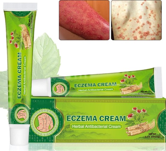 Sumifun - Eczema Skin Cream - 5 - CJ