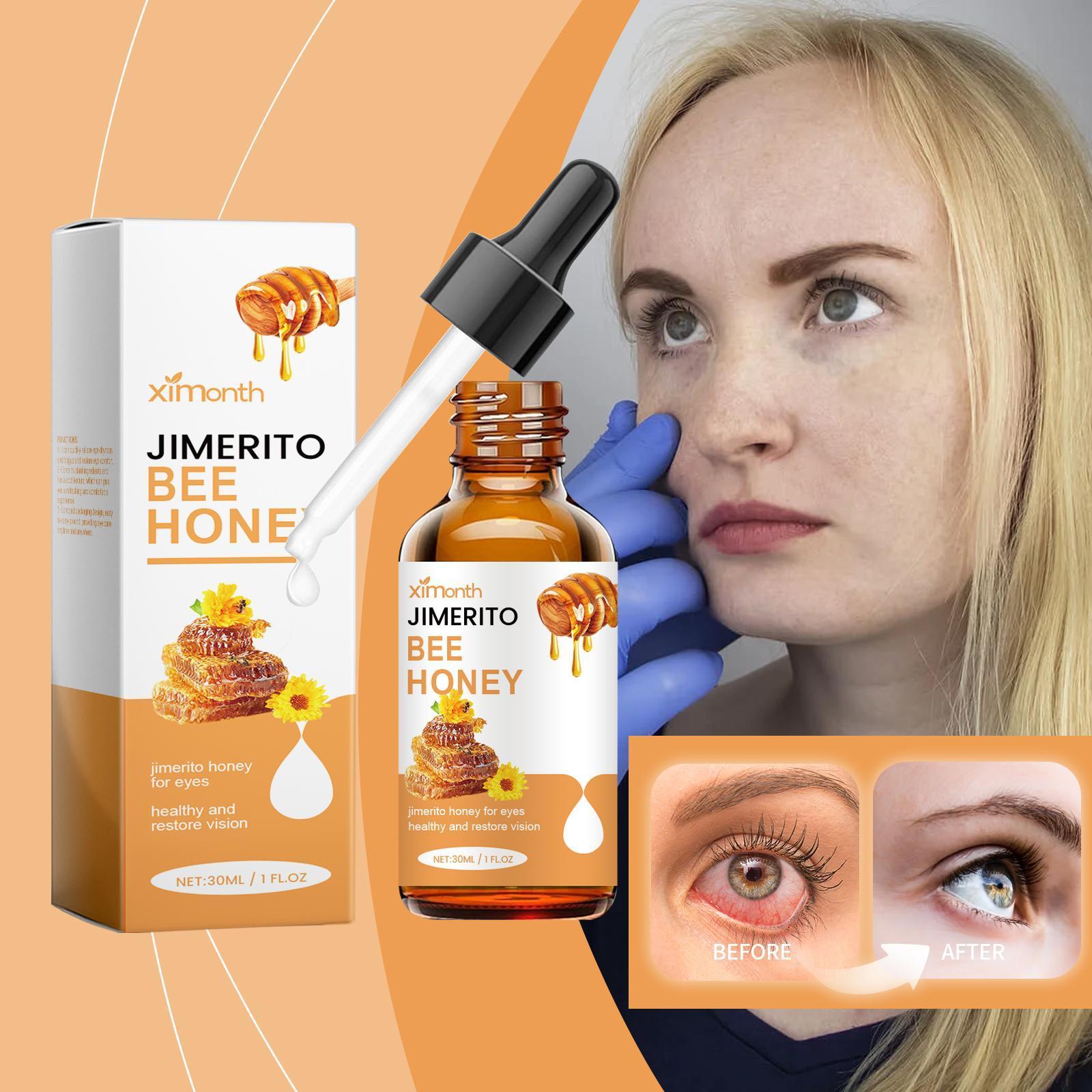 Ximengsijimeito Eye Honey Refreshing Moisturizing Soothing Dry Eyes Eye Drops - 5 - CJ