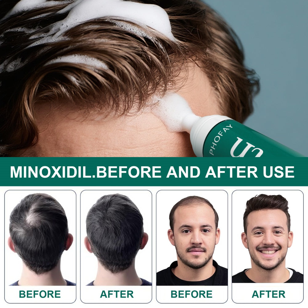 CH004 Minoxidil Anti - Hair Loss Mousse - 4 - CJ