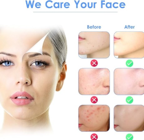 3 - in - 1 Ultrasonic Facial Skin Scrubber - 5 - CJ