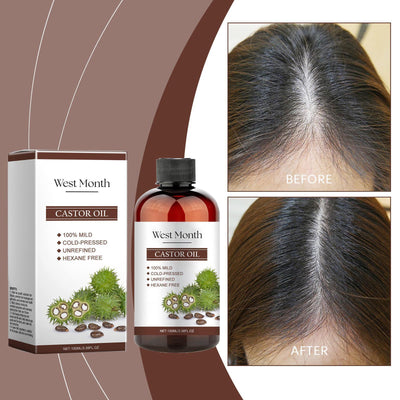 Xiyue All - in - one Castor Oil Is An Essential Oil For Multi - effect Care, Moisturizing Skin, Eyelashes And Eyebrows - 5 - CJ