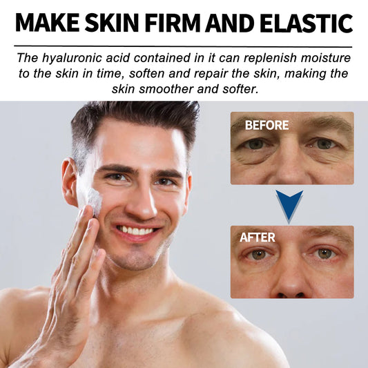 East Moon Men's Anti - wrinkle Cream To Lighten The Fine Lines And Wrinkles Tightening Facial Skin Hydration Anti - aging Cream - 5 - CJ