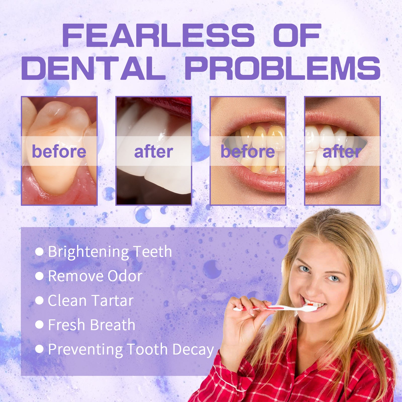 Jaysuing Purple Tooth Whitening Toothpaste Brightens Teeth, Cleanses Stains, Diminishes Odors, And Beauties Teeth Toothpaste - 5 - CJ