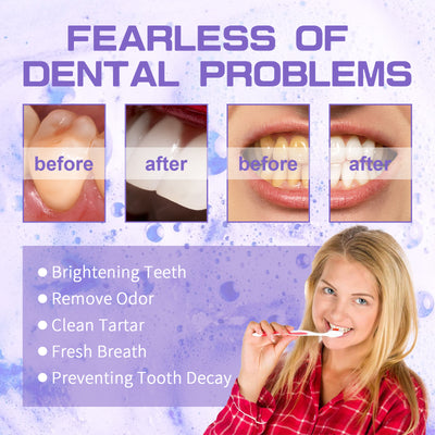Jaysuing Purple Tooth Whitening Toothpaste Brightens Teeth, Cleanses Stains, Diminishes Odors, And Beauties Teeth Toothpaste - 5 - CJ