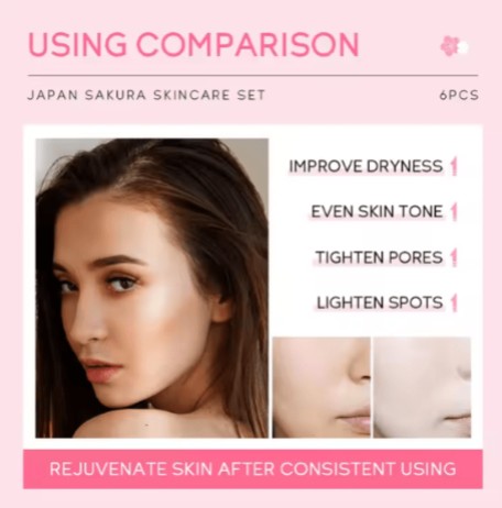 Japan Sakura - Skin Care Set - 5 - CJ