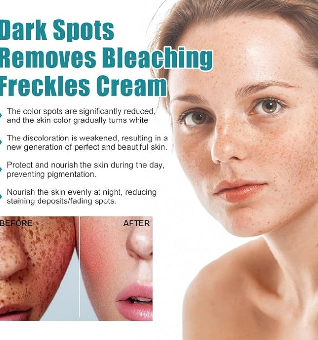 Eelhoe - Dark Spots Removes Cream - 5 - CJ