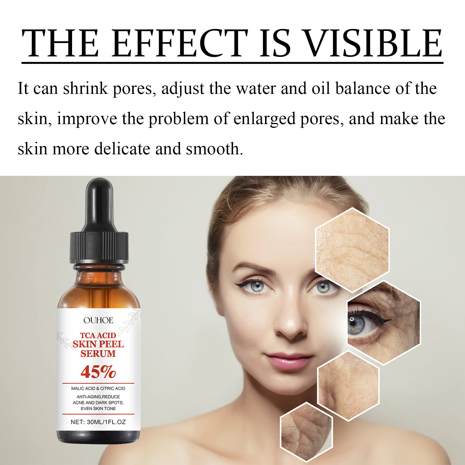 OUHOE TCA Acid Skin Peel Serum - 5 - CJ