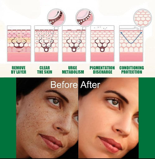 Eelhoe - Dark Spot Correcting Serum - 5 - CJ