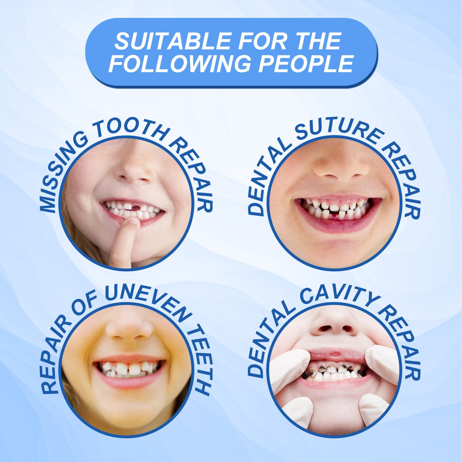 South Moon Solid Dental Gel Fixing Teeth Temporary Filling Cavities Filling Gel Dentures Denture Gap Filling Gel - 5 - CJ